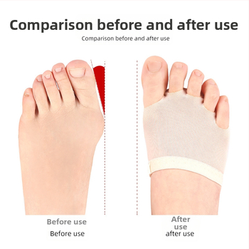 Viie auguga esijala hoolduskaitse varvastepadi kingakate hõõrdumisvastane jalakaitse harjutustantsutarbed esijalapadi pool