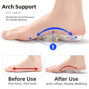 Permatomas pėdos arkos puspadis suaugusiesiems su išlenktomis kojomis viduje ir išorėje, ortopedinis pėdos arkos galinis padas, plokščias pėdos arkos atramos vidpadis