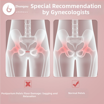 Σφιγκτήρας ποδιών για γυμναστές μυών πυελικού εδάφους για μετά τον τοκετό, άσκηση Kegel για πυελική χώρα, εσωτερικός μηρός, όμορφα πόδια