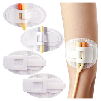 Устройство за фиксиране на катетър, Фиксатор за повърхностен катетър, Фиксатор за уринарен катетър, Пластир за фиксиране на дренажна тръба, Пластир за фиксиране на катетър