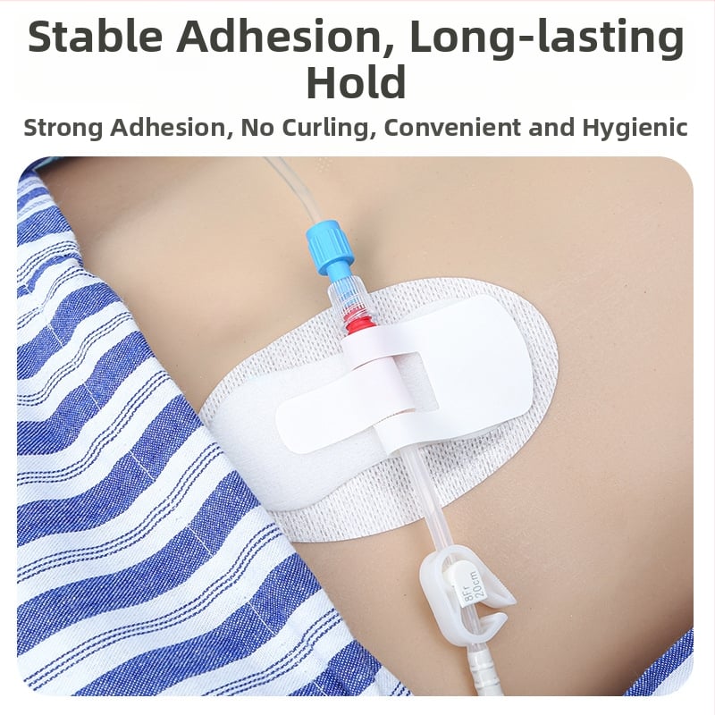 Медицински пластир за фиксация на катетър, пластир за фиксация на катетър, превръзка за фиксация на катетър, дренажна тръба, пластир за фиксация на PICC катетър