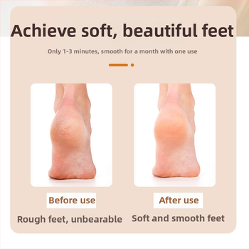 Pėdų šlifavimo įrankis, populiari ilgakotė nano stiklo pėdų dildė negyvai odai ir nuospaudoms šalinti, pedikiūro ir pėdų šveitimo artefaktai sandėlyje