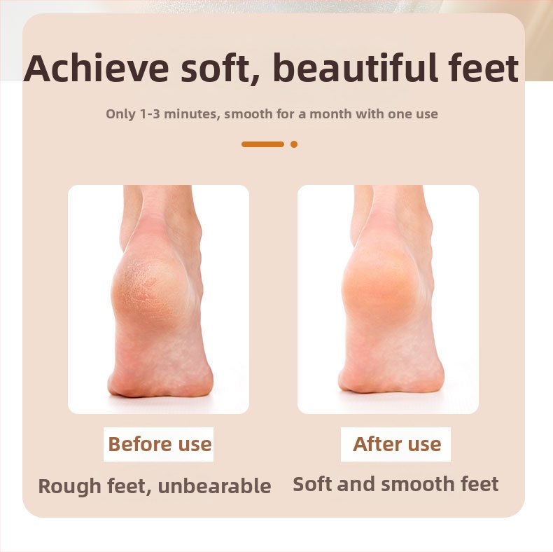 Инструмент за шлайфане на краката, популярна пила за крака с дълга дръжка от нано стъкло за премахване на мъртва кожа и мазоли, педикюр и артефакти от търкане на краката на склад