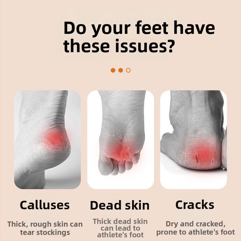 Инструмент за шлайфане на краката, популярна пила за крака с дълга дръжка от нано стъкло за премахване на мъртва кожа и мазоли, педикюр и артефакти от търкане на краката на склад