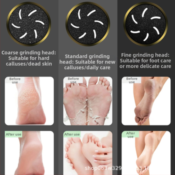 Užsienio prekybos vietoje nauji elektriniai priešskraidantys dribsniai, negyvos odos šalinimo prietaisai, pėdų šlifuokliai, pėdų šveitikliai, pedikiūro aparatai, pėdų priežiūros prietaisai