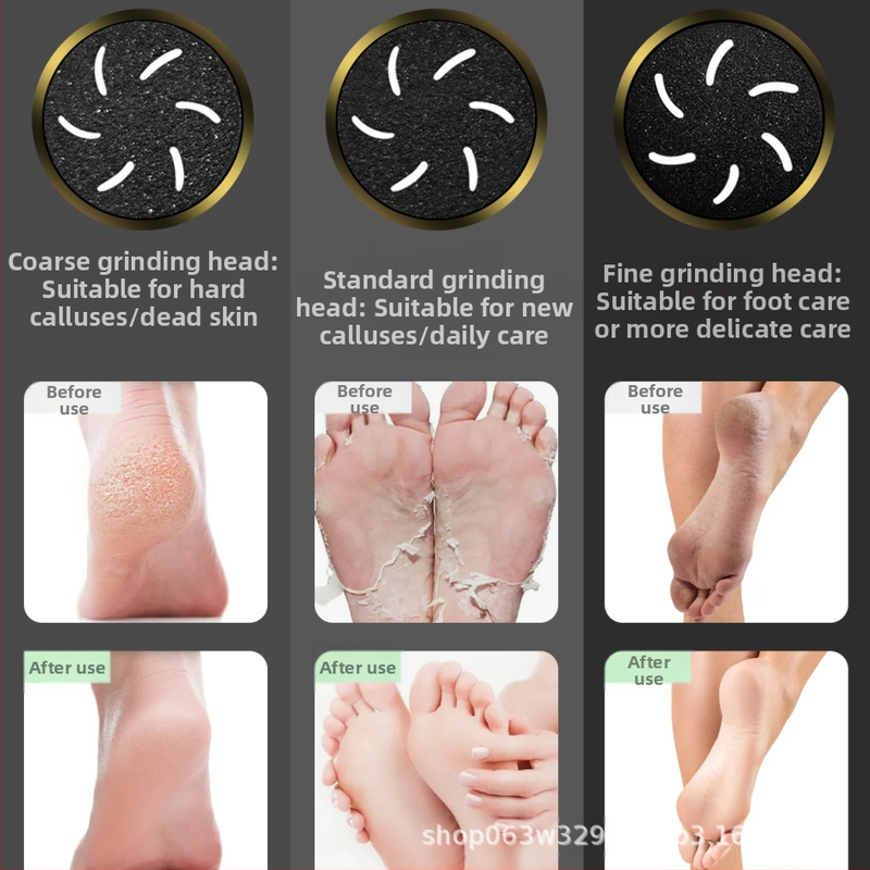 Užsienio prekybos vietoje nauji elektriniai priešskraidantys dribsniai, negyvos odos šalinimo prietaisai, pėdų šlifuokliai, pėdų šveitikliai, pedikiūro aparatai, pėdų priežiūros prietaisai