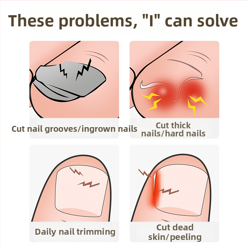 Нова нокторезачка за нокти, специални ножици за нокти, наклонени клещи за удължаване на устата, единични клещи за враснал нокът на крака, нокторезачки за педикюр