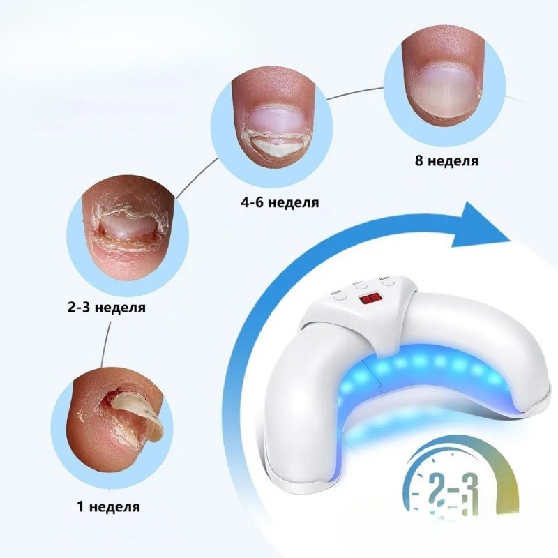 Intelligentse kiiresti kuivava poolkuukujulise küünelambi täiustatud versioon, mustaks muutumisevastane kahe valgusallikaga fototeraapia küünte induktsiooni teleskoop-U-kujuline lamp