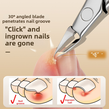 Üksikud küünetangid, spetsiaalsed küünetangid küünesoonte jaoks, sobivad küünetangid, kaldus pediküüri tööriistad, olecranon küünetangid