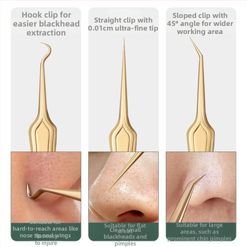 Väliskaubanduse akne nõelraku klambriülikond akne eemaldamise mustpeade pintsetid üliteravad peened pigistavad akne tööriistad ilu kingituste genereerimine