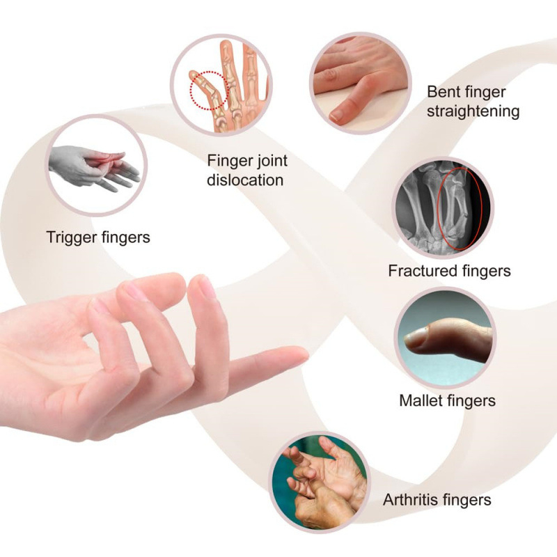 Pirštų koregavimo gaubtas, reguliuojamas plastinis sąnario fiksavimas, delno apsauga