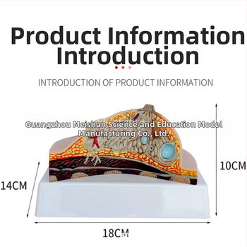 Μοντέλο παθολογίας μαστού για ιατρική εκπαίδευση