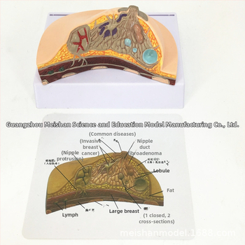 Μοντέλο παθολογίας μαστού για ιατρική εκπαίδευση