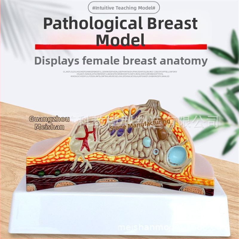 Μοντέλο παθολογίας μαστού για ιατρική εκπαίδευση