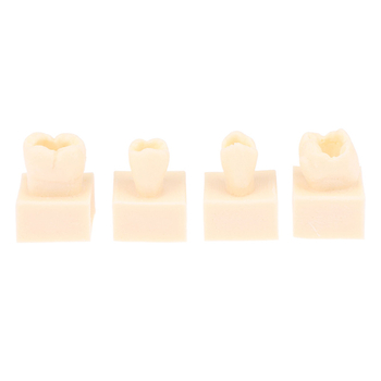Дентален тренировъчен модел за запълване със смола — за възрастни, около 22 г