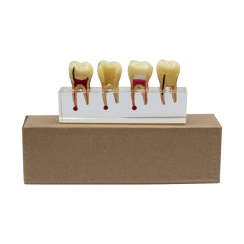 Model educațional stomatologic pentru dinți temporari pediatric cu carie și tratamentul pulpei, GC OEM, 108 g, cod de bare 236, Importat: Nu