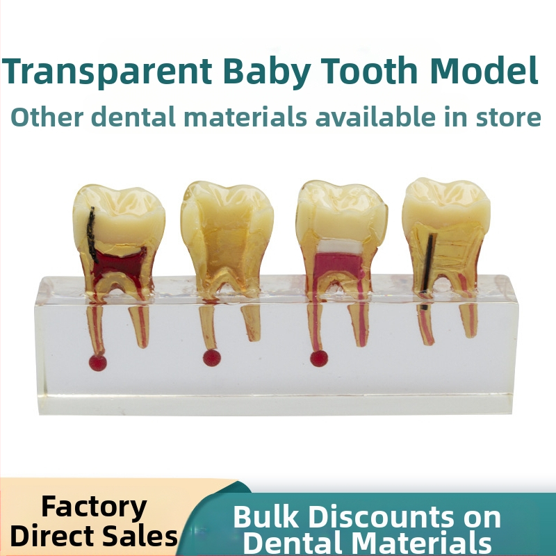 Model educațional stomatologic pentru dinți temporari pediatric cu carie și tratamentul pulpei, GC OEM, 108 g, cod de bare 236, Importat: Nu