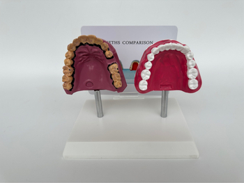 Dantų anatomijos modelis su struktūrine forma mokymui ir burnos sveikatos švietimui