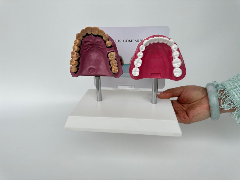 Dantų anatomijos modelis su struktūrine forma mokymui ir burnos sveikatos švietimui