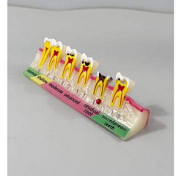 Month Ρητίνη Οδοντιατρικό Εκπαιδευτικό Μοντέλο – Επικοινωνία Ασθενούς-Γιατρού, Περιοδοντικό Μοντέλο Κατηγορίας B