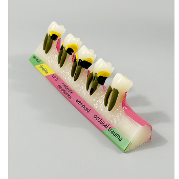 Month Ρητίνη Οδοντιατρικό Εκπαιδευτικό Μοντέλο – Επικοινωνία Ασθενούς-Γιατρού, Περιοδοντικό Μοντέλο Κατηγορίας B