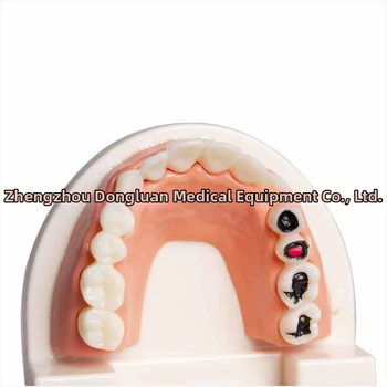 Shang Shang οδοντικό μοντέλο διδασκαλίας για ενήλικες, μιας χρήσης, 90 g, σετ 100