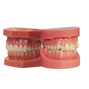 Zobu modelis maloklūzijas demonstrācijai un ortodontikas apmācībai (Zīmols: Leap to the courage; Pieaugušie; 100 gabali; Hebei)