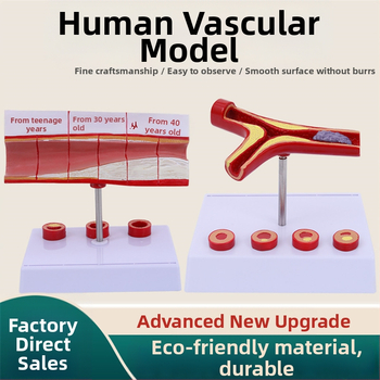 Модел за съдова патология: тромбоза, атеросклероза и артерийна хипертрофия