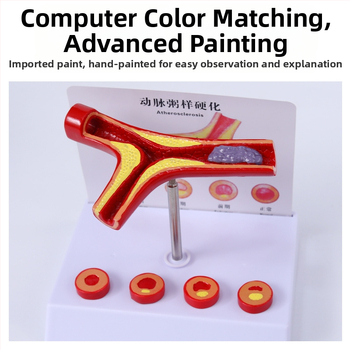 Модел за съдова патология: тромбоза, атеросклероза и артерийна хипертрофия