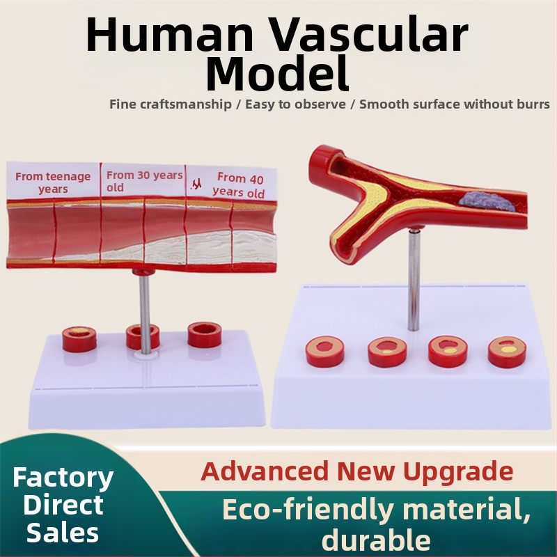 Модел за съдова патология: тромбоза, атеросклероза и артерийна хипертрофия