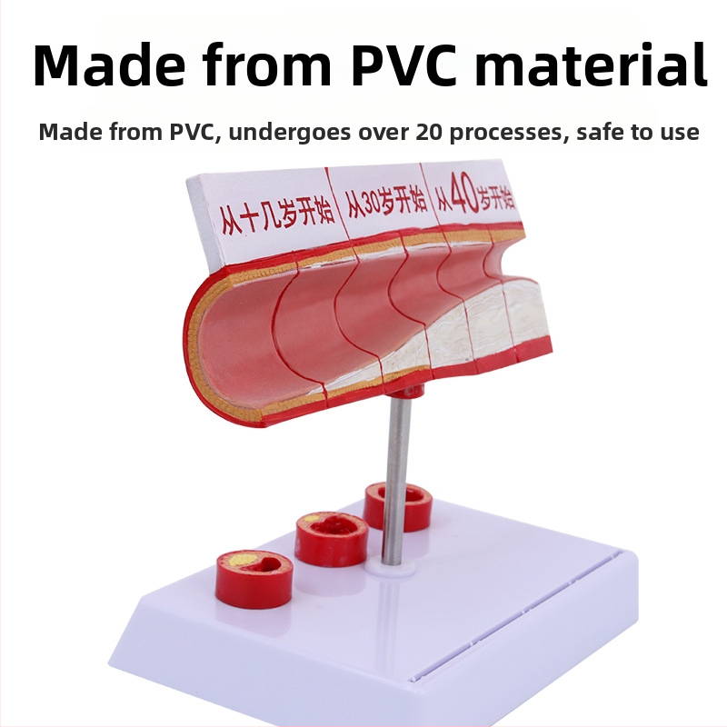 Модел за съдова патология: тромбоза, атеросклероза и артерийна хипертрофия