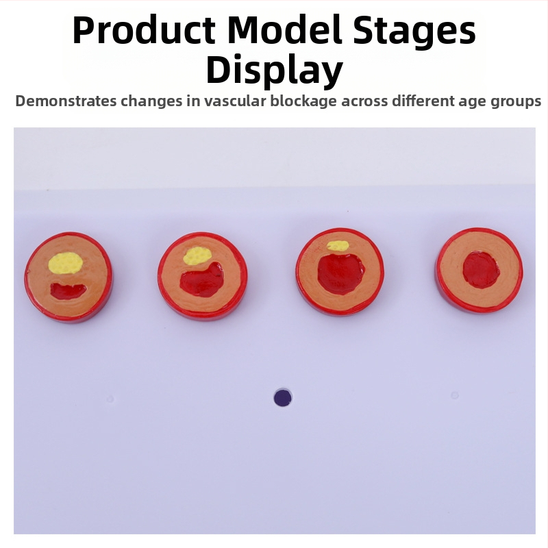 Модел за съдова патология: тромбоза, атеросклероза и артерийна хипертрофия