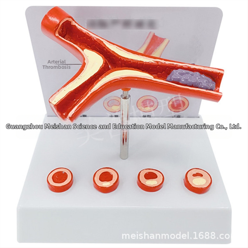 Модел за съдова патология: тромбоза, атеросклероза и артерийна хипертрофия