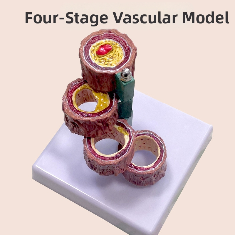 Модел за съдова патология: тромбоза, атеросклероза и артерийна хипертрофия
