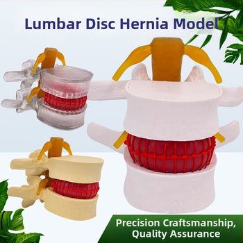 Лумбален модел за медицинско обучение – демонстрация на компресия на лумбалния диск и патология на костите на гръбначния стълб.