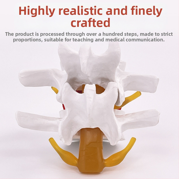 Лумбален модел за медицинско обучение – демонстрация на компресия на лумбалния диск и патология на костите на гръбначния стълб.