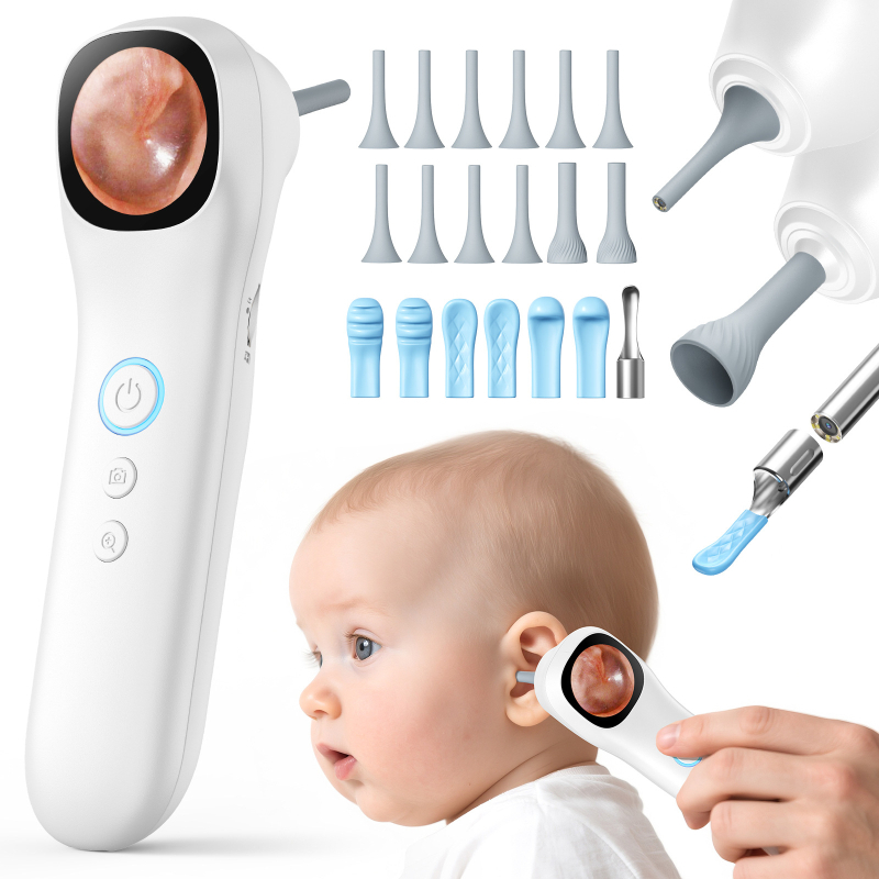 Ωτοσκόπιο υψηλής ευκρίνειας με έξυπνη οπτική προβολή για έλεγχο του ακουστικού πόρου, Glow τύποι ακουστικών και σετ ακουστικών, υλικό ABS+PC, 40 τεμάχια ανά κουτί