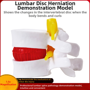 Модел на междупрешленния диск, PVC учебен анатомичен модел за демонстрация на патология на лумбалния гръбнак, Zhenghe River