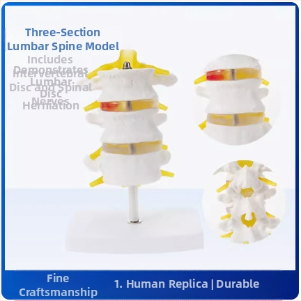 Модел на междупрешленния диск, PVC учебен анатомичен модел за демонстрация на патология на лумбалния гръбнак, Zhenghe River