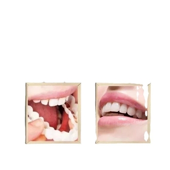 Προσωρινή οδοντική προσθετική για φαγητό — νάρθηκας κάλυψης πρόσθίων δοντιών σε περιπτώσεις ελλείποντων δοντιών, για ενήλικες