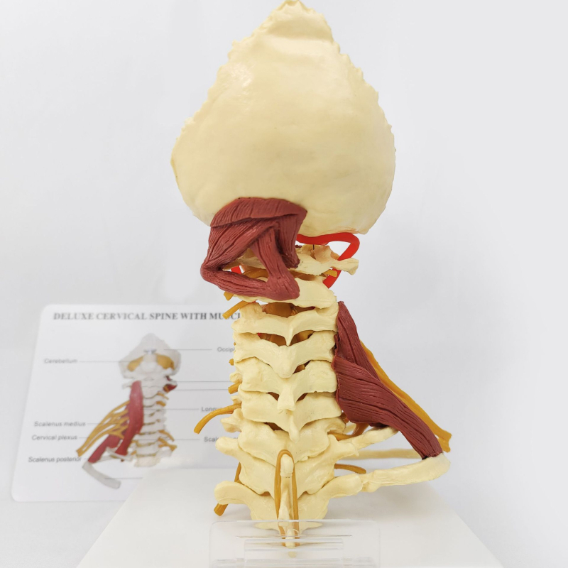 Ανατομικό μοντέλο - ανθρώπινο μυοσκελετικό μοντέλο με αυχενικούς σπονδύλους, γόνατο, ισχίο, αγκώνα και συνδέσμους ώμων; PVC, στατικό μοντέλο, έλεγχος 1