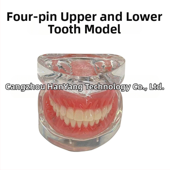 Gyakorló fogimplantátum modell – felső- és alsó állkapocs, fél szájban 2 vagy 4 implantátummal