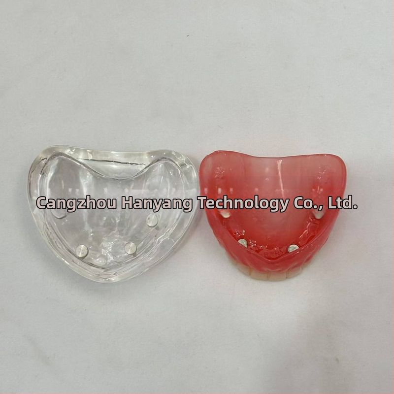 Gyakorló fogimplantátum modell – felső- és alsó állkapocs, fél szájban 2 vagy 4 implantátummal