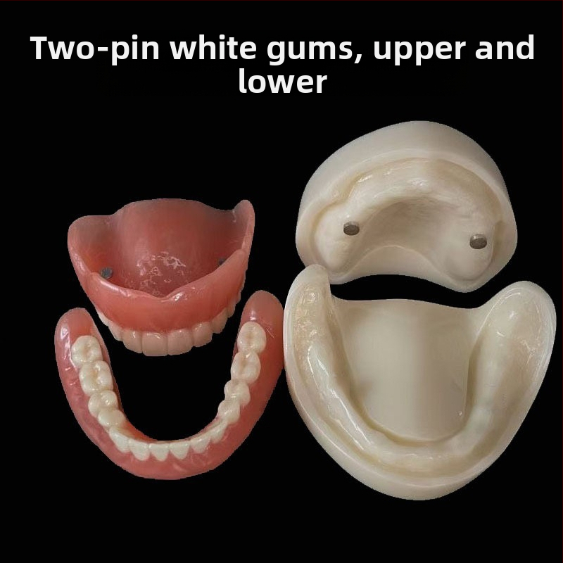 Gyakorló fogimplantátum modell – felső- és alsó állkapocs, fél szájban 2 vagy 4 implantátummal