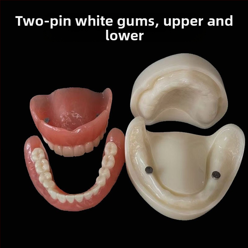 Gyakorló fogimplantátum modell – felső- és alsó állkapocs, fél szájban 2 vagy 4 implantátummal