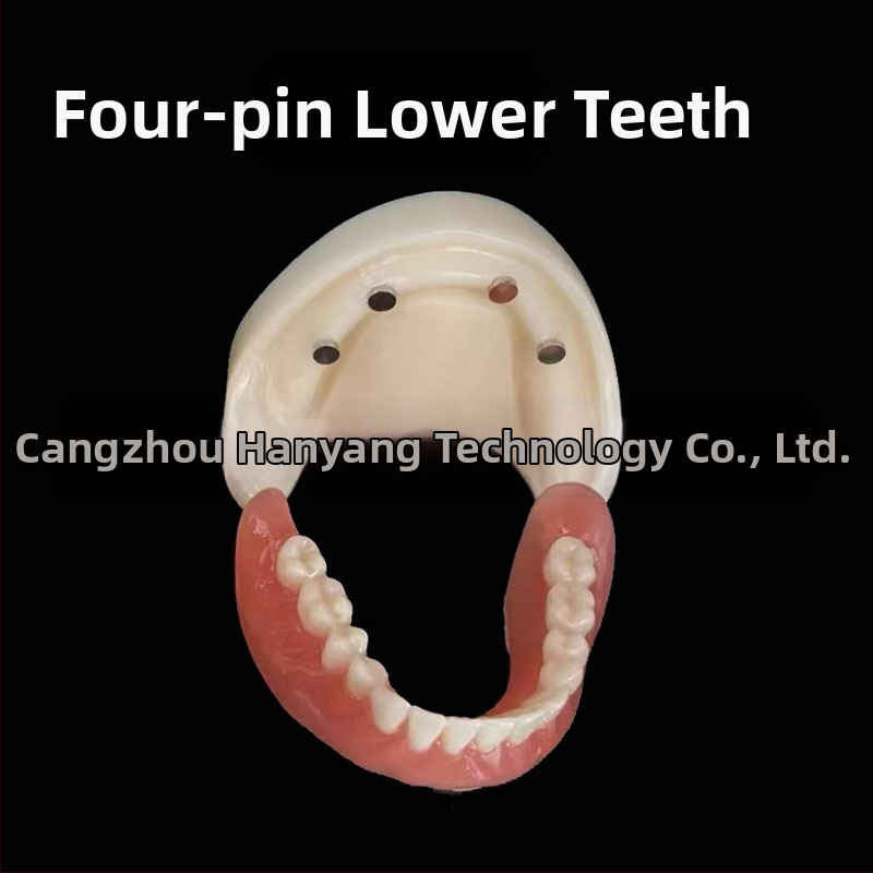 Gyakorló fogimplantátum modell – felső- és alsó állkapocs, fél szájban 2 vagy 4 implantátummal