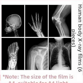 Jucărie educațională Montessori-Reggio cu lumină și umbră, inel DIY cu raze X, pentru sugari 0–3 ani, colț științific pentru fete