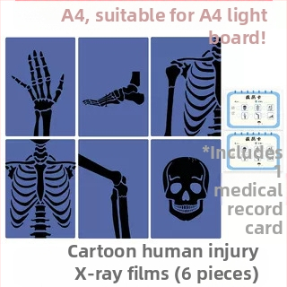 Jucărie educațională Montessori-Reggio cu lumină și umbră, inel DIY cu raze X, pentru sugari 0–3 ani, colț științific pentru fete