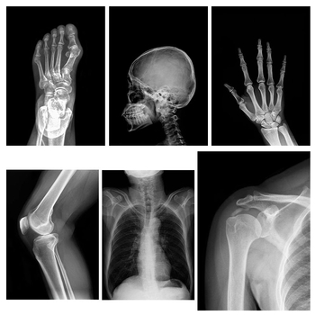 Εκπαιδευτικό παιχνίδι Μοντεσσόρι-Ρέτζιο με φως και σκιά, DIY δαχτυλίδι ακτινογραφίας, για βρέφη 0–3 ετών, γωνιά επιστήμης