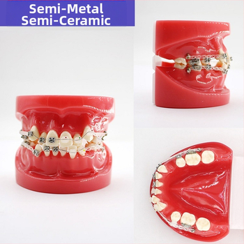 Μοντέλο διδασκαλίας οδοντιατρικής με παθολογική αποκατάσταση και τυπικό καλούπι εμφυτευμάτων — εγχώριο εμπορικό σήμα, με εκτυπωμένο λογότυπο, κατάλληλο για την οδοντιατρική εκπαίδευση